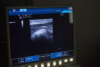 ultrasound 3